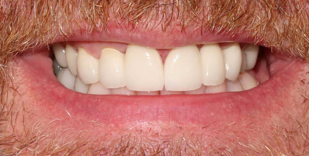 dental case study after