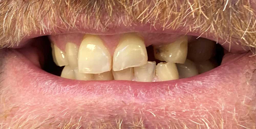 dental case study before