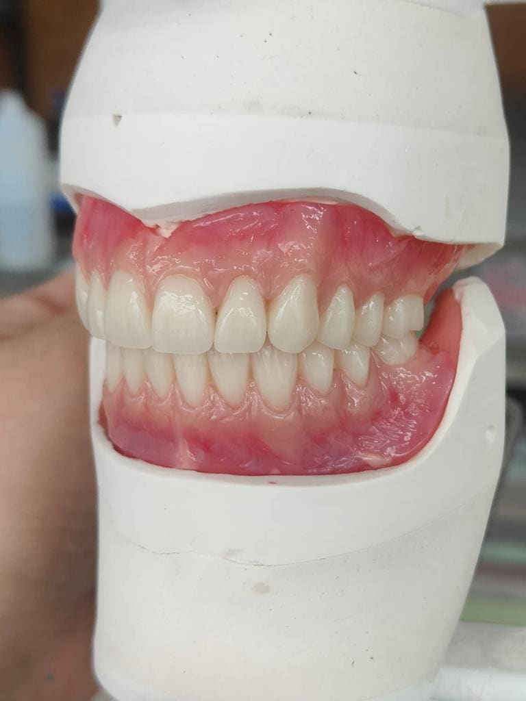 dentures bury manchester